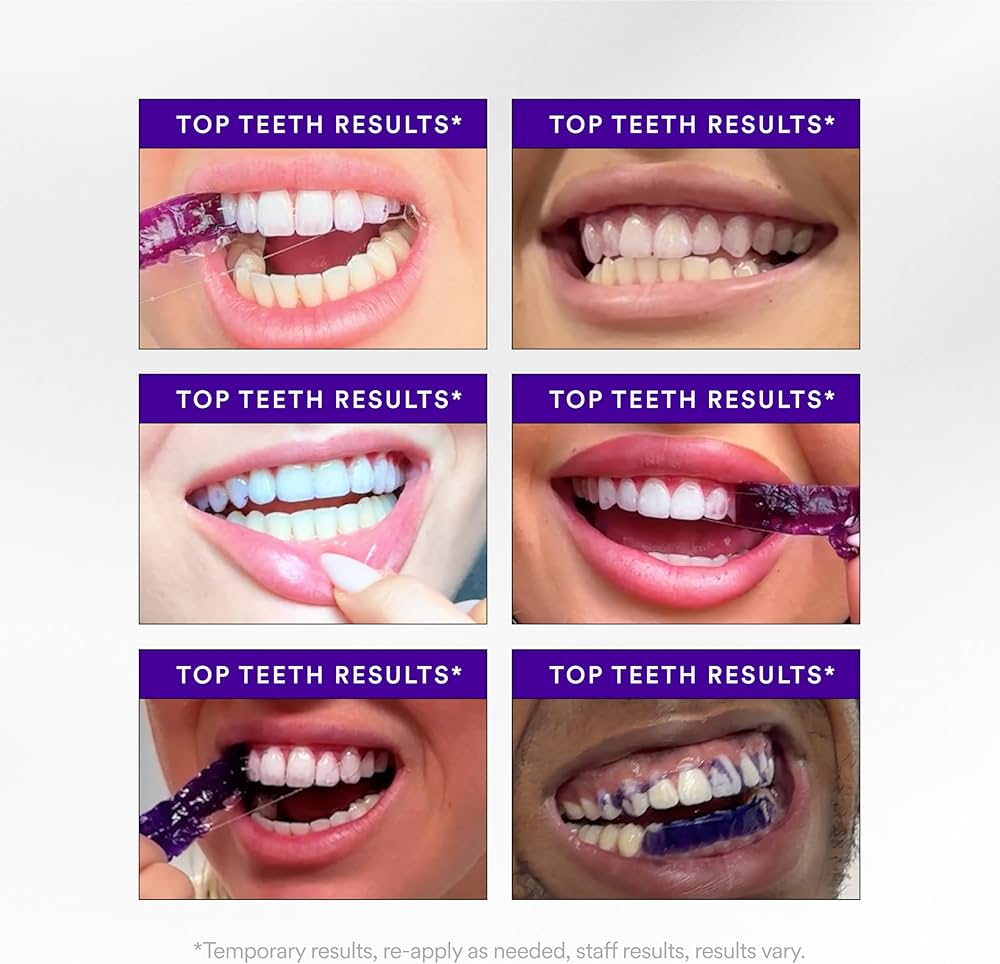 PURPLE WHITENING STRIPS
