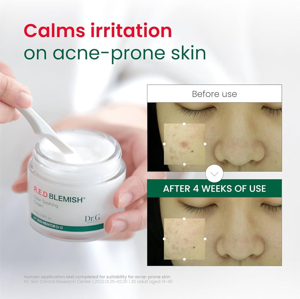Dr. G R.E.D. Blemish Clear Soothing Cream - Calming Korean Moisturizer for Redness - Soothes Acne & Irritation - With Centella Asiatica - Long-Lasting Hydration - 2.36 fl oz