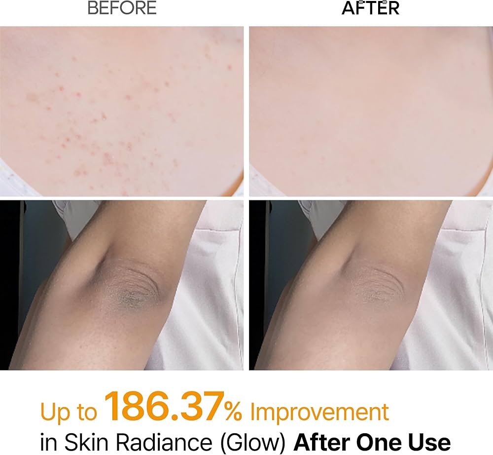 Dr.Melaxin Peel Shot Keratin Care
Kojic Acid Turmeric Spray 200ml