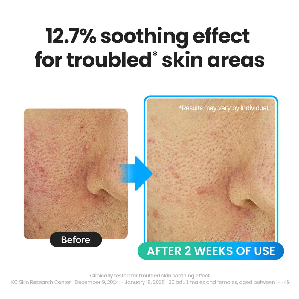 DR.G R.E.D BLEMISH COOL SOOTHING TROUBLE GEL MASK